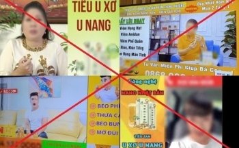 Khe hở quản lý trong sự bát nháo của thị trường thực phẩm chức năng
