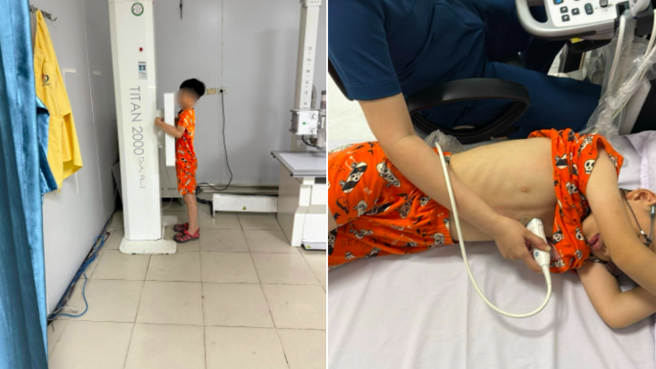 Phụ huynh cho con đi trại hè về bị viêm da và ảnh hưởng tâm lý nghiêm trọng. Ảnh: NVCC