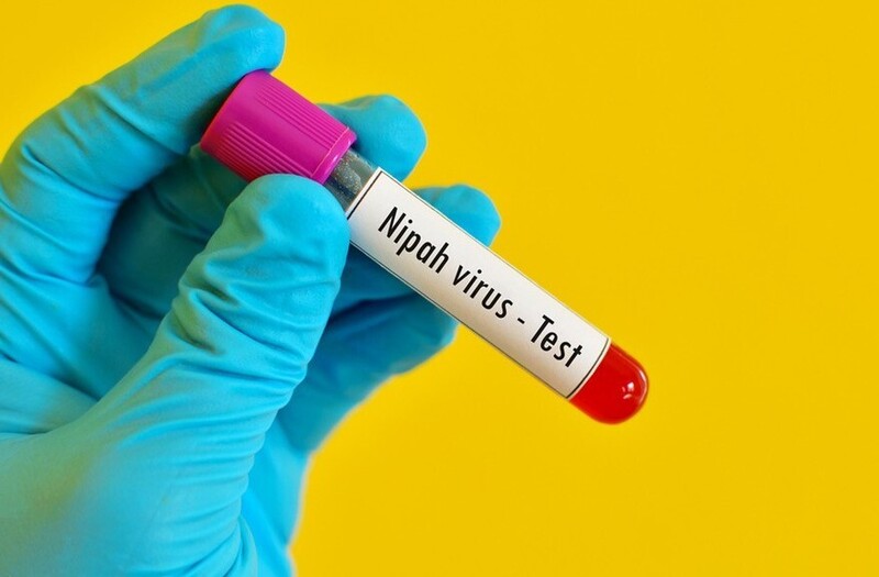 Đặc điểm dịch tễ của Nipah là mầm bệnh lây truyền từ động vật sang người, có khả năng lây giữa người với người và tỷ lệ tử vong cao. Ảnh minh hoạ