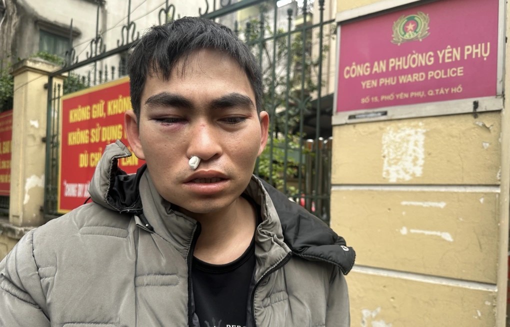 Cơ quan chức năng xác định, anh Hưng bị chấn động não tỷ lệ tổn hại thương tích là: 3% Cơ quan chức năng xác định, anh Hưng bị chấn động não tỷ lệ tổn hại thương tích là: 3%